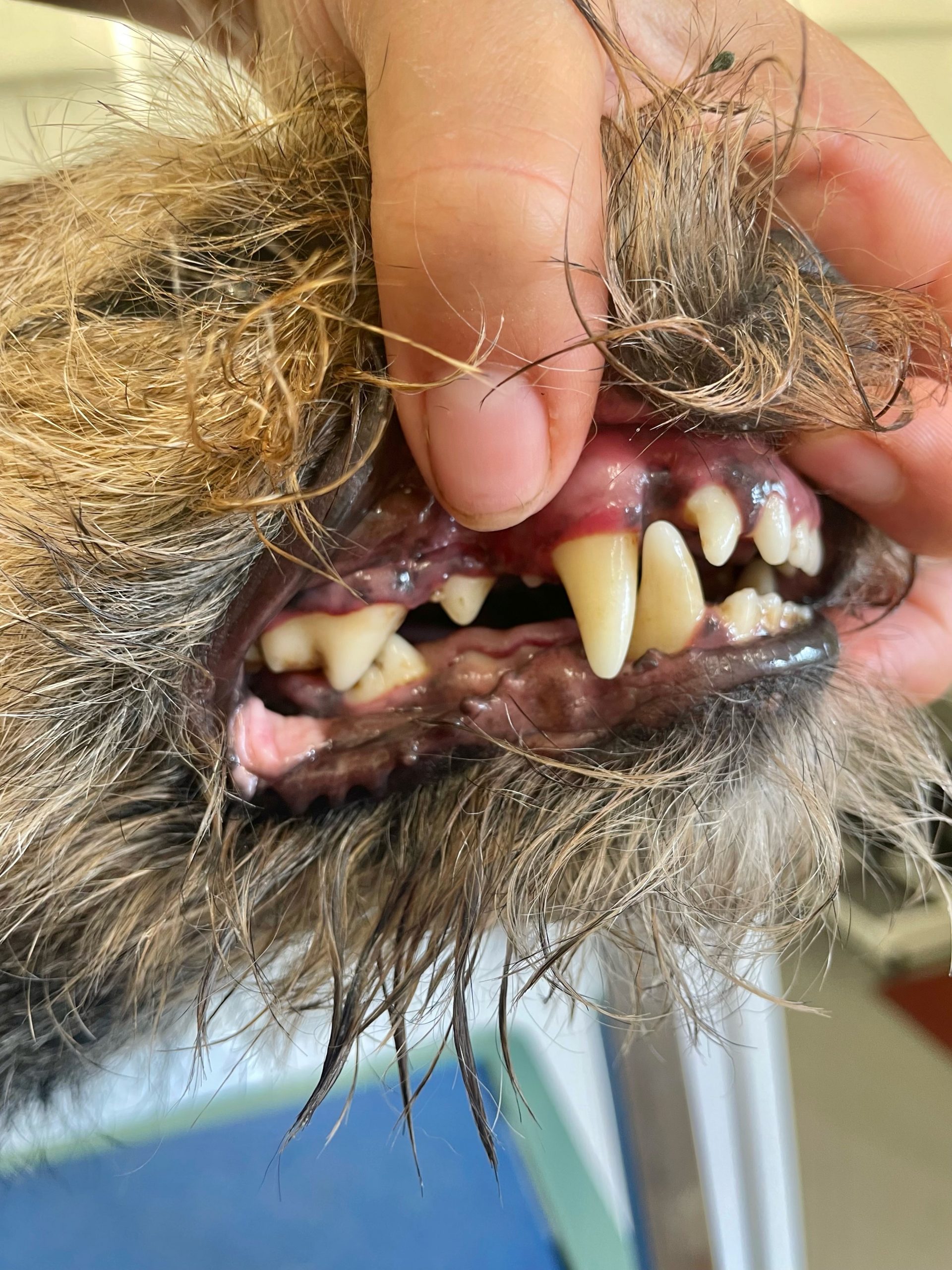 teeth1